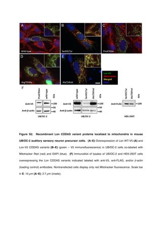 Figure S2. Recombinant Lon CODAS variant proteins localized to mitochondria in mouse
UB/OC-2 auditory sensory neuron precursor cells. (A–E) Overexpression of Lon WT-V5 (A) and
Lon-V5 CODAS variants (B–E) (green – V5 immunofluorescence) in UB/OC-2 cells co-labeled with
Mitotracker Red (red) and DAPI (blue). (F) Immunoblot of lysates of UB/OC-2 and HEK-293T cells
overexpressing the Lon CODAS variants indicated labeled with anti-V5, anti-FLAG, and/or β-actin
(loading control) antibodies. Nontransfected cells display only red Mitotracker fluorescence. Scale bar
in E: 10 µm (A–E); 2.7 µm (insets).
 