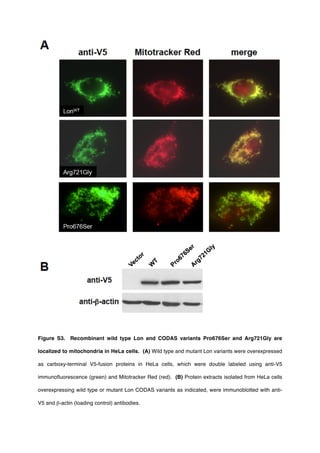 Figure S3. Recombinant wild type Lon and CODAS variants Pro676Ser and Arg721Gly are
localized to mitochondria in HeLa cells. (A) Wild type and mutant Lon variants were overexpressed
as carboxy-terminal V5-fusion proteins in HeLa cells, which were double labeled using anti-V5
immunofluorescence (green) and Mitotracker Red (red). (B) Protein extracts isolated from HeLa cells
overexpressing wild type or mutant Lon CODAS variants as indicated, were immunoblotted with anti-
V5 and β-actin (loading control) antibodies.
 
