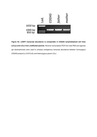 Figure S4. LONP1 transcript abundance is comparable in CODAS lymphoblastoid cell lines
(LCLs) and LCLs from unaffected parents. Reverse transcriptase PCR from total RNA and agarose
gel electrophoresis were used to compare endogenous transcript abundance between homozygous
CODAS proband (c.2161CG) and heterozygous parent LCLs.
 
