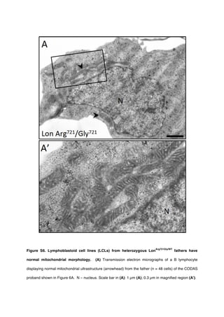 Figure S6. Lymphoblastoid cell lines (LCLs) from heterozygous Lon
Arg721Gly/WT
fathers have
normal mitochondrial morphology. (A) Transmission electron micrographs of a B lymphocyte
displaying normal mitochondrial ultrastructure (arrowhead) from the father (n = 48 cells) of the CODAS
proband shown in Figure 6A. N – nucleus. Scale bar in (A): 1 µm (A); 0.3 µm in magnified region (A').
 