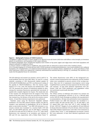 250 nM wild-type and mutant Lon proteins, and 0.5 mM S3. To
avoid problems from the inner ﬁlter effect, we used S3, a mixed
substrate consisting of 10% ﬂuorescently labeled peptide S2
[Y(NO2)RGITCSGRQK(Abz)] and 90% non-ﬂuorescent analog of
the peptide S1 (YRGITCSGRQK(Ac)). After the mixture equili-
brated at 37
C for 1 min, the reaction was initiated with 1 mM
ATP. We measured the amount of hydrolyzed peptide by deter-
mining the maximum ﬂuorescence generated per micromole of
peptide after complete digestion by trypsin. The steady-state rate
of the reaction was determined from the tangent of the linear
portion of the time course. This rate was converted to an observed
rate constant (kobs) by division of the rate by the enzyme concen-
tration. At least three identical experiments were performed.
Peptidase assays using the ﬂuorescent dipeptide substrate
rhodamine 110, bis-(CBZ-L-alanyl-L-alanine amide) (AA2-Rh110,
Anaspec), were performed in quadruplicate (20 ml) in 384-well
plates as previously described.39
Lon (800 nM monomer) or no-
enzyme controls were incubated in a reaction buffer (150 mM
NaCl, 50 mM HEPES [pH 8.0], and 10 mM MgCl2) containing
AA2-Rh110 (6 mM) and ATP (2 mM) for 3 hr at 37
C, after which
ﬂuorescence was measured at an excitation and emission of
485 and 535 nm, respectively, with a Perkin Elmer Victor3
V.
The relative ﬂuorescence units (RFU) of the background (no-
enzyme control) measurements were subtracted, and the resultant
values were normalized to percent activity of the no-drug reac-
tions. Data were ﬁt to 4-parameter dose-response curves using
GraphPad Prism 6, and the error bars represent the SD of four repli-
cate reactions. At least three identical experiments were per-
formed. StAR and TFAM puriﬁcation and degradation assays
were performed as previously described.19,41,44,45
ATPase Assay
The ATPase activity of wild-type and mutant Lon variants was
measured in quadruplicate reactions (5 ml) in a 384-well plate
via the ADP-Glo Assay (Promega) according to the manufacturer’s
recommendations. All steps were performed at room temperature.
Puriﬁed human Lon (400 nM monomer) was incubated in a
reaction buffer (40 mM Tris-HCl [pH 7.5], 20 mM MgCl2, and
0.1 mg/ml BSA) with Ultra Pure ATP (1 mM; Promega) for
60 min. ADP-GloÔ Reagent (5 ml) was added for 40 min followed
by Kinase Detection Substrate (10 ml) for 60 min, which was linear
with [ADP]. Relative luminescence units (RLU) were measured on
a Perkin Elmer Victor3
V, and background (no-enzyme control)
RLU were subtracted. At least three identical experiments were
performed.
Figure 2. Radiographic Features of CODAS Syndrome
(A) Sagittal T1 (upper) and axial T2 (lower) images of an affected 4-year-old Amish child show mild diffuse cortical atrophy, an immature
pattern of myelination, and hypoplasia of the corpus callosum.
(B) Skeletal radiographs show metaphyseal dysplasia most evident at hip joints (upper) and valgus knees with both hypoplasia and
delayed ossiﬁcation of epiphyses (lower).
(C) Severe scoliosis is evident early in childhood, and coronal clefts are observed at various levels of the vertebral column.
(D–G) Prenatal imaging of a 32-week-old fetus with CODAS syndrome revealed polyhydramnios, a two-vessel umbilical cord, midfacial
hypoplasia, (D) crumpled helices, (E) a balanced atrioventricular canal, (F) common atrium, omphalocele, (G, arrow) and absence of left
lower long bones, which were replaced by a relatively well-formed foot attached directly to the hip. (G, arrowhead) The asterisk in (G)
marks the left palpebral ﬁssure for orientation.
124 The American Journal of Human Genetics 96, 121–135, January 8, 2015
 