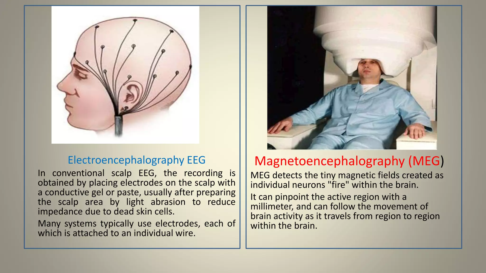 Electroencephalography EEG
In conventional scalp EEG, the recording is
obtained by placing electrodes on the scalp with
a conductive gel or paste, usually after preparing
the scalp area by light abrasion to reduce
impedance due to dead skin cells.
Many systems typically use electrodes, each of
which is attached to an individual wire.
Magnetoencephalography (MEG)
MEG detects the tiny magnetic fields created as
individual neurons "fire" within the brain.
It can pinpoint the active region with a
millimeter, and can follow the movement of
brain activity as it travels from region to region
within the brain.
 