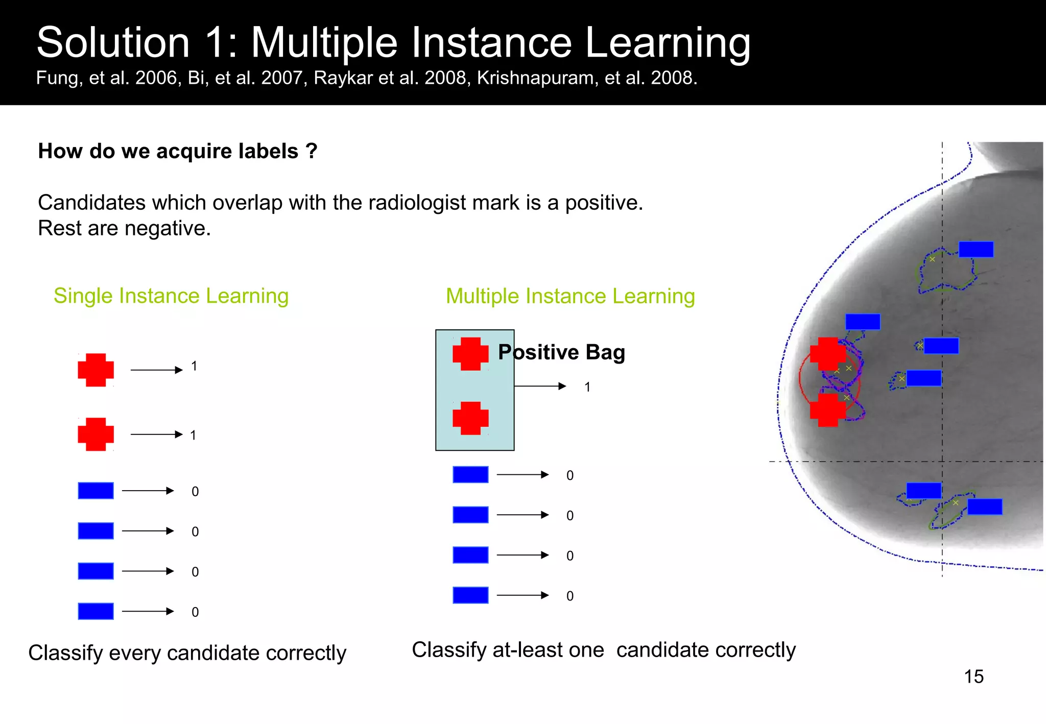 Solution 1: Multiple Instance Learning
Fung, et al. 2006, Bi, et al. 2007, Raykar et al. 2008, Krishnapuram, et al. 2008.
How do we acquire labels ?
Candidates which overlap with the radiologist mark is a positive.
Rest are negative.
1
1
0
0
0
0
Single Instance Learning
1
0
0
0
0
Multiple Instance Learning
Classify every candidate correctly
Positive Bag
Classify at-least one candidate correctly
15
 