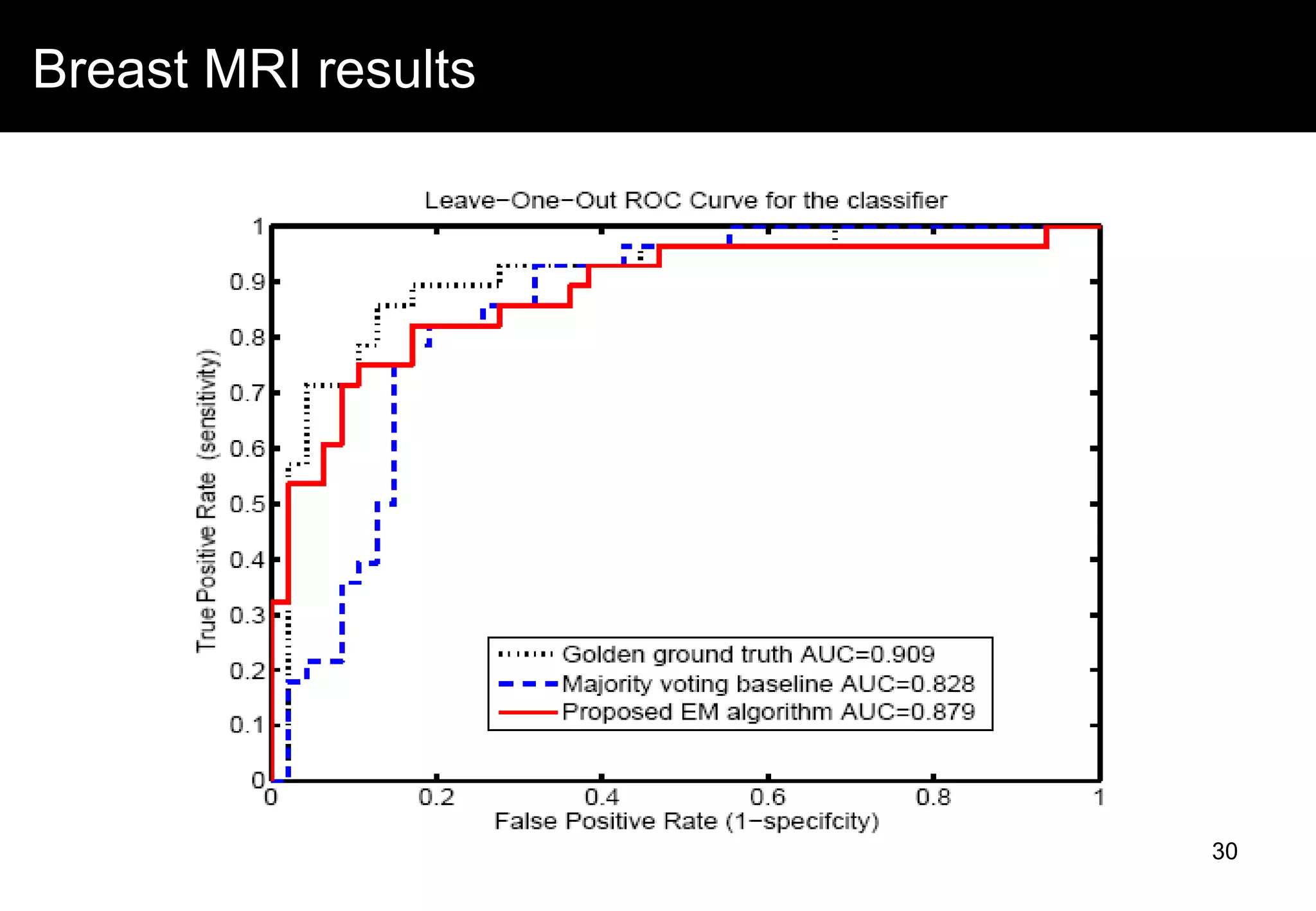 Breast MRI results
30
 