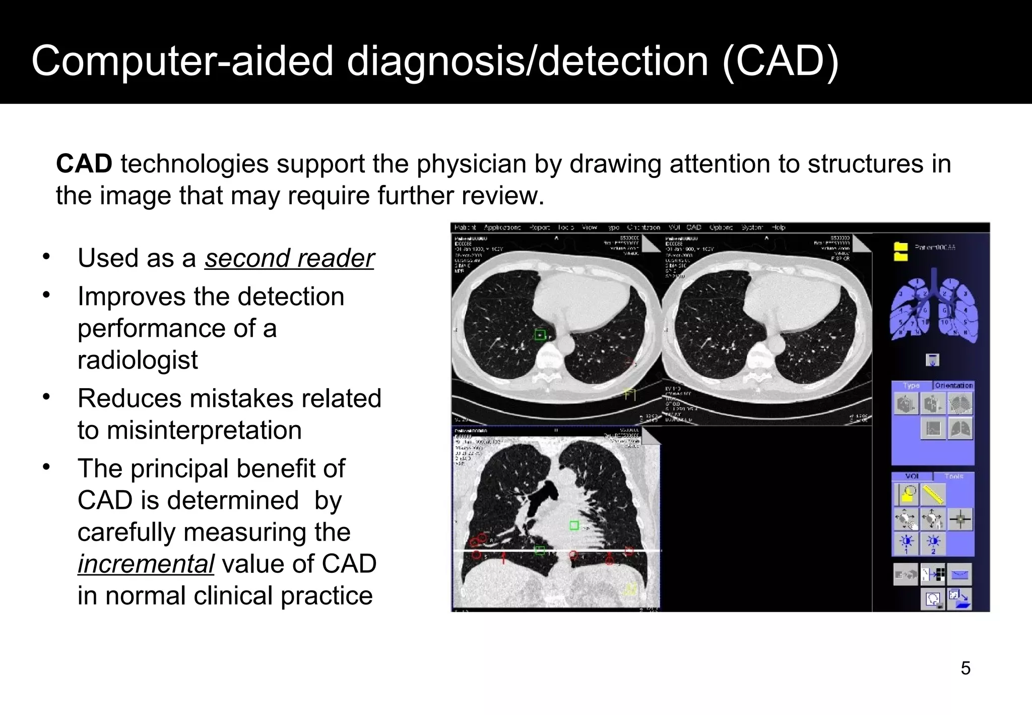 Computer-aided diagnosis/detection (CAD)
• Used as a second reader
• Improves the detection
performance of a
radiologist
• Reduces mistakes related
to misinterpretation
• The principal benefit of
CAD is determined by
carefully measuring the
incremental value of CAD
in normal clinical practice
CAD technologies support the physician by drawing attention to structures in
the image that may require further review.
5
 