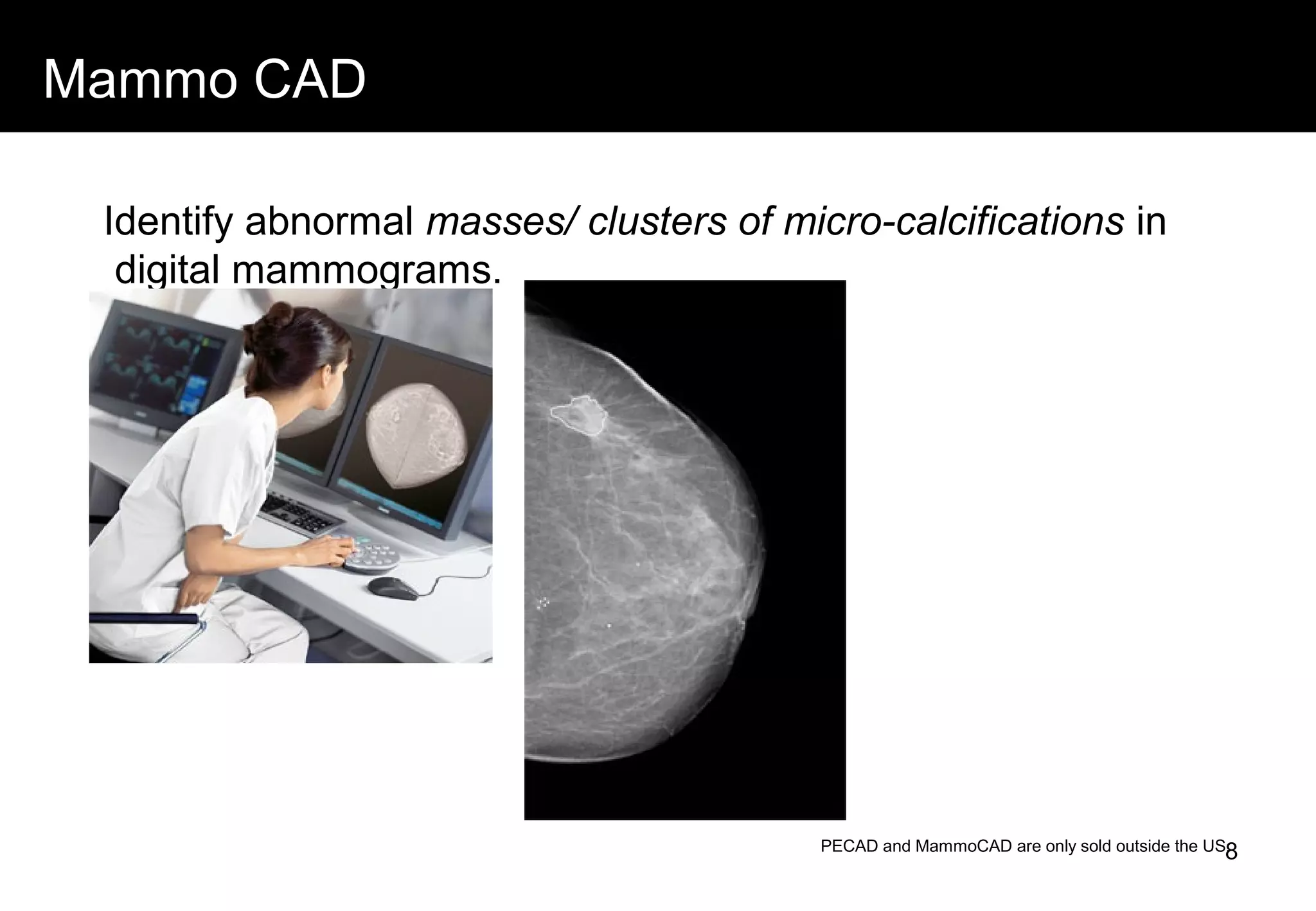 Mammo CAD
Identify abnormal masses/ clusters of micro-calcifications in
digital mammograms.
PECAD and MammoCAD are only sold outside the US.8
 