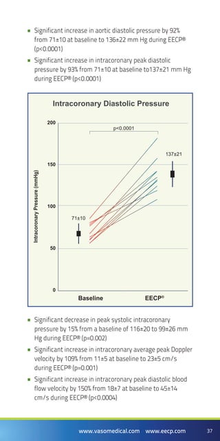 37www.vasomedical.com www.eecp.com
Significant increase in aortic diastolic pressure by 92%••
from 71±10 at baseline to 136±22 mm Hg during EECP®
(p<0.0001)
Significant increase in intracoronary peak diastolic••
pressure by 93% from 71±10 at baseline to137±21 mm Hg
during EECP® (p<0.0001)
Significant decrease in peak systolic intracoronary••
pressure by 15% from a baseline of 116±20 to 99±26 mm
Hg during EECP® (p=0.002)
Significant increase in intracoronary average peak Doppler••
velocity by 109% from 11±5 at baseline to 23±5 cm/s
during EECP® (p=0.001)
Significant increase in intracoronary peak diastolic blood••
flow velocity by 150% from 18±7 at baseline to 45±14
cm/s during EECP® (p<0.0004)
200
150
100
50
0
IntracoronaryPressure(mmHg)
Intracoronary Diastolic Pressure
Baseline EECP®
71±10
137±21
p<0.0001
 