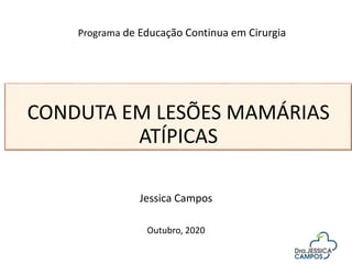 CONDUTA EM LESÕES MAMÁRIAS
ATÍPICAS
Jessica Campos
Outubro, 2020
Programa de Educação Continua em Cirurgia
 