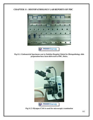 102
CHAPTER 11 : HISTOPATHOLOGY LAB REPORTS OF PDC
Fig.11.1. Endometrial Specimens sent to Zulekha Hospital, Dubai for Histopathology slide
preparation have been delivered to PDC, Deira.
Fig.11.2. Olympus CX41 is used for microscopic examination
 