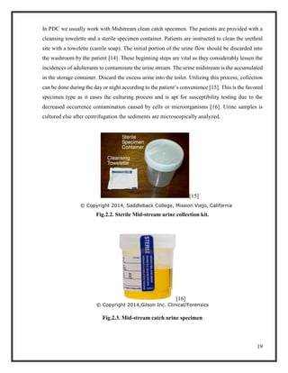19
In PDC we usually work with Midstream clean catch specimen. The patients are provided with a
cleansing towelette and a sterile specimen container. Patients are instructed to clean the urethral
site with a towelette (castile soap). The initial portion of the urine flow should be discarded into
the washroom by the patient [14]. These beginning steps are vital as they considerably lessen the
incidences of adulterants to contaminate the urine stream. The urine midstream is the accumulated
in the storage container. Discard the excess urine into the toilet. Utilizing this process, collection
can be done during the day or night according to the patient’s convenience [15]. This is the favored
specimen type as it eases the culturing process and is apt for susceptibility testing due to the
decreased occurrence contamination caused by cells or microorganisms [16]. Urine samples is
cultured else after centrifugation the sediments are microscopically analyzed.
[15]
© Copyright 2014, Saddleback College, Mission Viejo, California
Fig.2.2. Sterile Mid-stream urine collection kit.
[16]
© Copyright 2014,Gilson Inc. Clinical/Forensics
Fig.2.3. Mid-stream catch urine specimen
 