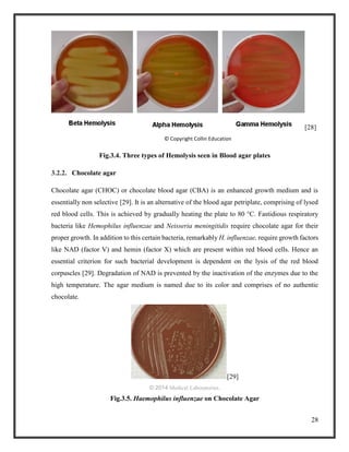 28
[28]
© Copyright Collin Education
Fig.3.4. Three types of Hemolysis seen in Blood agar plates
3.2.2. Chocolate agar
Chocolate agar (CHOC) or chocolate blood agar (CBA) is an enhanced growth medium and is
essentially non selective [29]. It is an alternative of the blood agar petriplate, comprising of lysed
red blood cells. This is achieved by gradually heating the plate to 80 °C. Fastidious respiratory
bacteria like Hemophilus influenzae and Neisseria meningitidis require chocolate agar for their
proper growth. In addition to this certain bacteria, remarkably H. influenzae, require growth factors
like NAD (factor V) and hemin (factor X) which are present within red blood cells. Hence an
essential criterion for such bacterial development is dependent on the lysis of the red blood
corpuscles [29]. Degradation of NAD is prevented by the inactivation of the enzymes due to the
high temperature. The agar medium is named due to its color and comprises of no authentic
chocolate.
[29]
© 2014 Medical Laboratories.
Fig.3.5. Haemophilus influenzae on Chocolate Agar
 