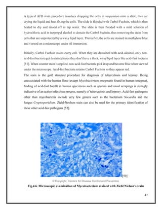 47
A typical AFB stain procedure involves dropping the cells in suspension onto a slide, then air
drying the liquid and heat fixing the cells. The slide is flooded with Carbol Fuchsin, which is then
heated to dry and rinsed off in tap water. The slide is then flooded with a mild solution of
hydrochloric acid in isopropyl alcohol to destain the Carbol Fuchsin, thus removing the stain from
cells that are unprotected by a waxy lipid layer. Thereafter, the cells are stained in methylene blue
and viewed on a microscope under oil immersion.
Initially, Carbol Fuchsin stains every cell. When they are destained with acid-alcohol, only non-
acid-fast bacteria get destained since they don't have a thick, waxy lipid layer like acid-fast bacteria
[51]. When counter stain is applied, non-acid-fast bacteria pick it up and become blue when viewed
under the microscope. Acid-fast bacteria retains Carbol Fuchsin so they appear red.
The stain is the gold standard procedure for diagnosis of tuberculosis and leprosy. Being
unassociated with the human flora (except Mycobacterium smegmatis found in human smegma),
finding of acid-fast bacilli in human specimens such as sputum and nasal scrapings is strongly
indicative of an active infectious process, namely of tuberculosis and leprosy. Acid-fast pathogens
other than mycobacteria include very few genera such as the bacterium Nocardia and the
fungus Cryptosporidium. Ziehl-Neelson stain can also be used for the primary identification of
these other acid-fast pathogens [52].
[50]
© Copyright, Centers for Disease Control and Prevention
Fig.4.6. Microscopic examination of Mycobacterium stained with Ziehl Nielson's stain
 