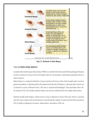 82
[70]
Fig.7.2. Methods of Skin Biopsy
7.2.3. LYMPH NODE BIOPSY
Lymph node (small organs that produce WBCs to combat infections and kill the pathogens) biopsy
involves removal of tissue from the lymph node for microscopic examination generally done to
detect cancers.
Open biopsy is a surgical method to extract a portion of tissue or the entire lymph node. Local or
general anesthetic is administered to the patient and, the site of biopsy is cleansed and a minor cut
is formed to excise sufficient tissue. The area is sutured and bandaged. This procedure takes 30-
45 minutes [75]. Fine needle aspirate biopsy can also be conducted for the lymph node tumors.
Sentinel lymph node biopsy would involve using a radioactive tracer/ blue dye which is injected
into the tumor region and its penetration is traced and the sample is removed from those locations
[76]. It helps in diagnosis of cancer, tuberculosis, sarcoidosis, HIV etc.
 