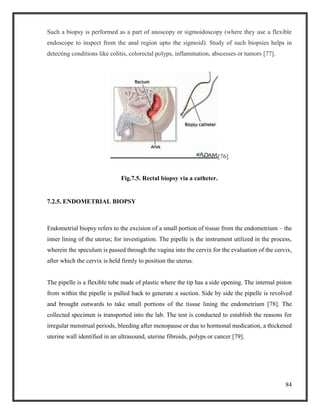 84
Such a biopsy is performed as a part of anoscopy or sigmoidoscopy (where they use a flexible
endoscope to inspect from the anal region upto the sigmoid). Study of such biopsies helps in
detecting conditions like colitis, colorectal polyps, inflammation, abscesses or tumors [77].
[76]
Fig.7.5. Rectal biopsy via a catheter.
7.2.5. ENDOMETRIAL BIOPSY
Endometrial biopsy refers to the excision of a small portion of tissue from the endometrium – the
inner lining of the uterus; for investigation. The pipelle is the instrument utilized in the process,
wherein the speculum is passed through the vagina into the cervix for the evaluation of the cervix,
after which the cervix is held firmly to position the uterus.
The pipelle is a flexible tube made of plastic where the tip has a side opening. The internal piston
from within the pipelle is pulled back to generate a suction. Side by side the pipelle is revolved
and brought outwards to take small portions of the tissue lining the endometrium [78]. The
collected specimen is transported into the lab. The test is conducted to establish the reasons for
irregular menstrual periods, bleeding after menopause or due to hormonal medication, a thickened
uterine wall identified in an ultrasound, uterine fibroids, polyps or cancer [79].
 