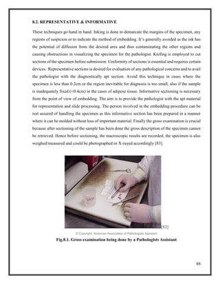 88
8.2. REPRESENTATIVE & INFORMATIVE
These techniques go hand in hand. Inking is done to demarcate the margins of the specimen, any
regions of suspicion or to indicate the method of embedding. It’s generally avoided as the ink has
the potential of diffusion from the desired area and thus contaminating the other regions and
causing obstructions in visualizing the specimen for the pathologist. Knifing is employed to cut
sections of the specimen before submission. Uniformity of sections is essential and requires certain
devices. Representative sections is desired for evaluation of any pathological concerns and to avail
the pathologist with the diagnostically apt section. Avoid this technique in cases where the
specimen is less than 0.2cm or the region inevitable for diagnosis is too small, also if the sample
is inadequately fixed (<0.4cm) in the cases of adipose tissue. Informative sectioning is necessary
from the point of view of embedding. The aim is to provide the pathologist with the apt material
for representation and slide processing. The person involved in the embedding procedure can be
rest assured of handling the specimen as this informative section has been prepared in a manner
where it can be molded without loss of important material. Finally the gross examination is crucial
because after sectioning of the sample has been done the gross description of the specimen cannot
be retrieved. Hence before sectioning, the macroscopic results are recorded, the specimen is also
weighed/measured and could be photographed or X-rayed accordingly [83].
[82]
© Copyright, American Association of Pathologists Assistant
Fig.8.1. Gross examination being done by a Pathologists Assistant
 