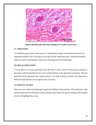 94
[89]
Fig.9.8. Hematoxylin and eosin staining of Nocardia crassostreae
9.7. MOUNTING
For indefinite preservation of the tissue it is dehydrated yet again with alcohol and toluol. An
automated machine will fix the glass cover slip over the stained specimen. And these prepared
slides are sent for microscopic visualization and diagnosis by the pathologist.
9.8. DECALCIFICATION
In cases where we receive specimens from the bone or bone marrow which possess calcium, a
procedure called decalcification has to be conducted prior to the specimens sectioning. After the
dissection of the specimen (into small portions), it is kept in plastic cassettes and immersed in
RDO for decalcification for an approximate of 4 hours.
9.9. SPECIAL STAINS
There are cases where the pathologist requires the different characteristics of the specimen or the
chemicals present to be distinctly visible and hence they request for special staining of the samples
which will highlight these areas.
 