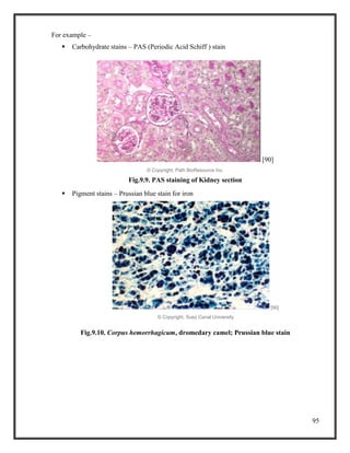 95
For example –
 Carbohydrate stains – PAS (Periodic Acid Schiff ) stain
[90]
© Copyright, Path BioResource Inc.
Fig.9.9. PAS staining of Kidney section
 Pigment stains – Prussian blue stain for iron
[90]
© Copyright, Suez Canal University
Fig.9.10. Corpus hemorrhagicum, dromedary camel; Prussian blue stain
 