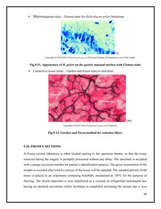 96
 Microorganism stain – Giemsa stain for Helicobacter pylori bacterium
[90]
Copyright © 2014 BMJ Publishing Group Ltd & Royal College of Paediatrics and Child health
Fig.9.11. Appearance of H. pylori on the gastric mucosal surface with Giemsa stain
 Connective tissue stains – Gordon and Sweet stain or reticulum
[90]
Copyright © 2014 BMJ Publishing Group Ltd & Histonet
Fig.9.12. Gordon and Sweet method for reticular fibers
9.10. FROZEN SECTIONS
A frozen section laboratory is often located nearing to the operation theatre, so that the tissue
removed during the surgery is promptly processed without any delay. The specimen is accepted
with a unique accession number for patient’s identification purpose. The gross examination of the
sample is recorded after which a section of the tissue will be sampled. The sampled portion of the
tissue is placed in an isopentane containing histobath, maintained at -50°C for the purpose of
freezing. The frozen specimen is now transferred to a cryostat (a refrigerated instrument) box
having an attached microtome which facilitates in simplified sectioning the tissues into a 5µm
 