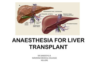ANAESTHESIA FOR LIVER
TRANSPLANT
DR.SANDEEP.G.B.
NARAYANA MEDICAL COLLEGGE
NELLORE

 
