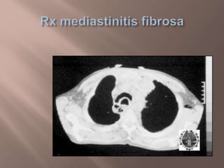 %D9%85%d8%af%d9%8a%d8%a7%d8%b3%d8%aa%d9%8a%d9%86%d9%8a%d8%aa