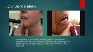 Jaw Jerk Reflex
The response to the stimulus is monosynaptic, with sensory
neurons of the trigeminal mesencephalic nucleus sending axons
to the trigeminal motor nucleus, which in turn innervates the
masseter
 