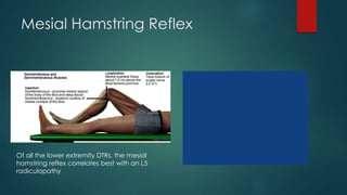 Mesial Hamstring Reflex
Of all the lower extremity DTRs, the mesial
hamstring reflex correlates best with an L5
radiculopathy
 