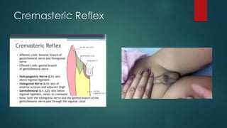 Cremasteric Reflex
 