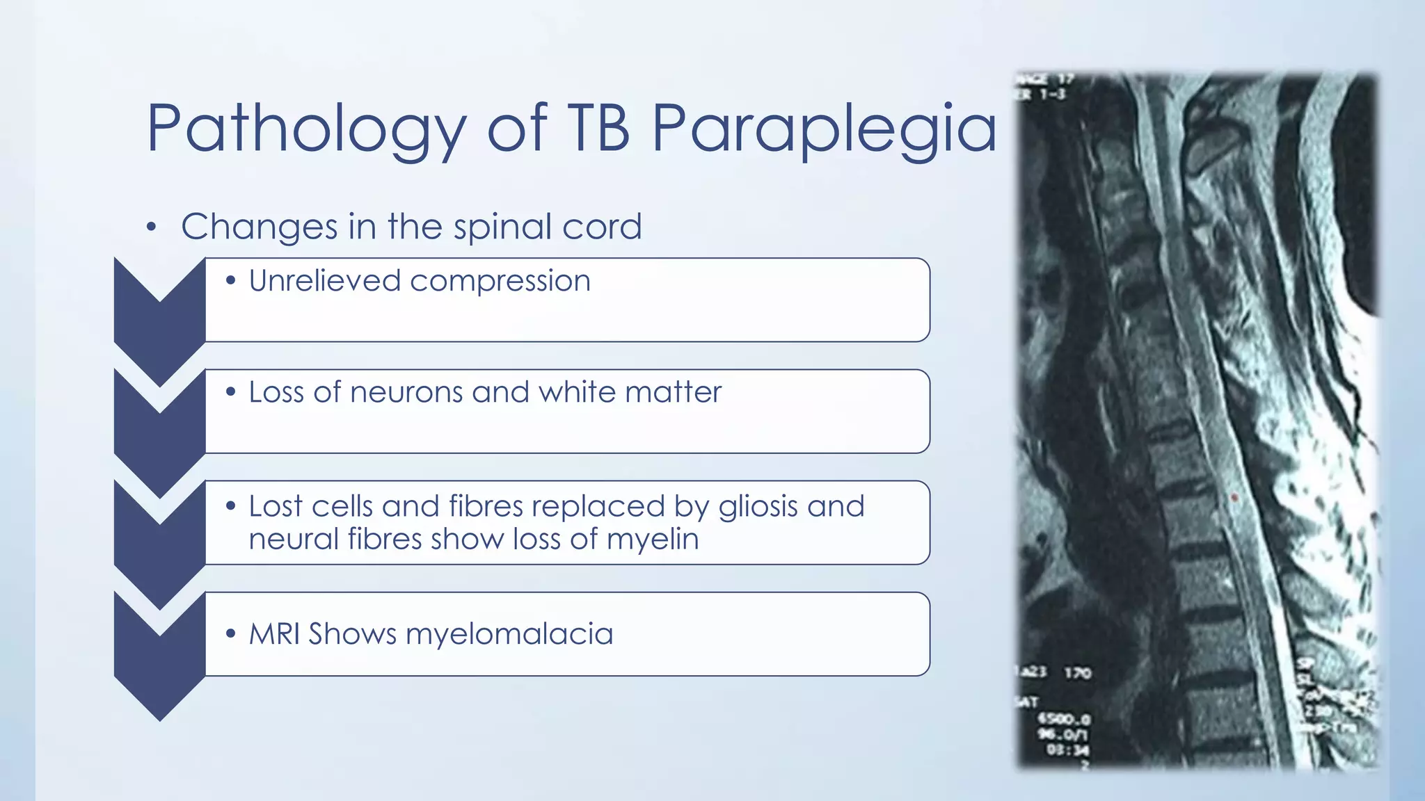 Pathology of TB Paraplegia
• Changes in the spinal cord
• Unrelieved compression
• Loss of neurons and white matter
• Lost cells and fibres replaced by gliosis and
neural fibres show loss of myelin
• MRI Shows myelomalacia
 