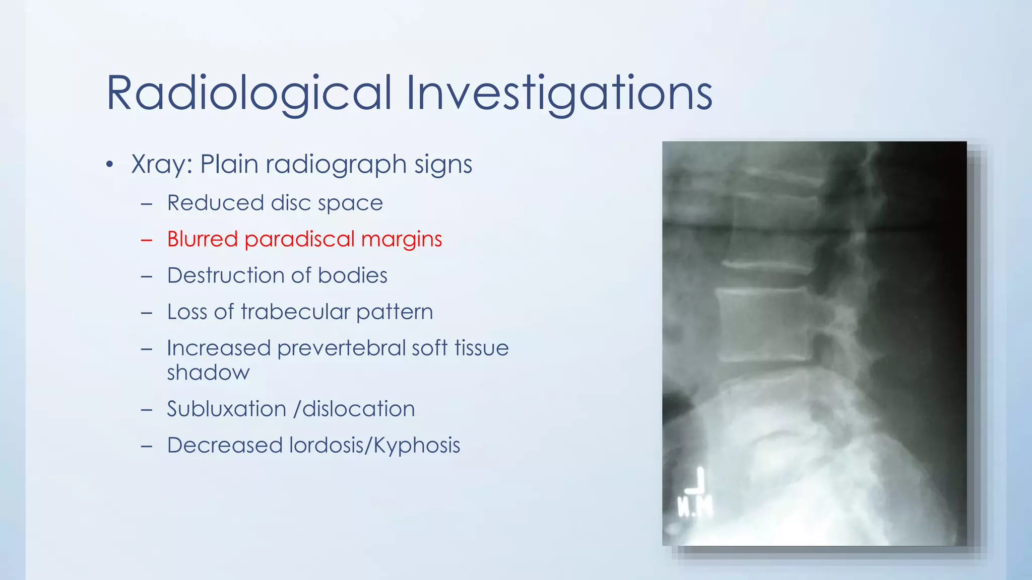 Radiological Investigations
• Xray: Plain radiograph signs
– Reduced disc space
– Blurred paradiscal margins
– Destruction of bodies
– Loss of trabecular pattern
– Increased prevertebral soft tissue
shadow
– Subluxation /dislocation
– Decreased lordosis/Kyphosis
 