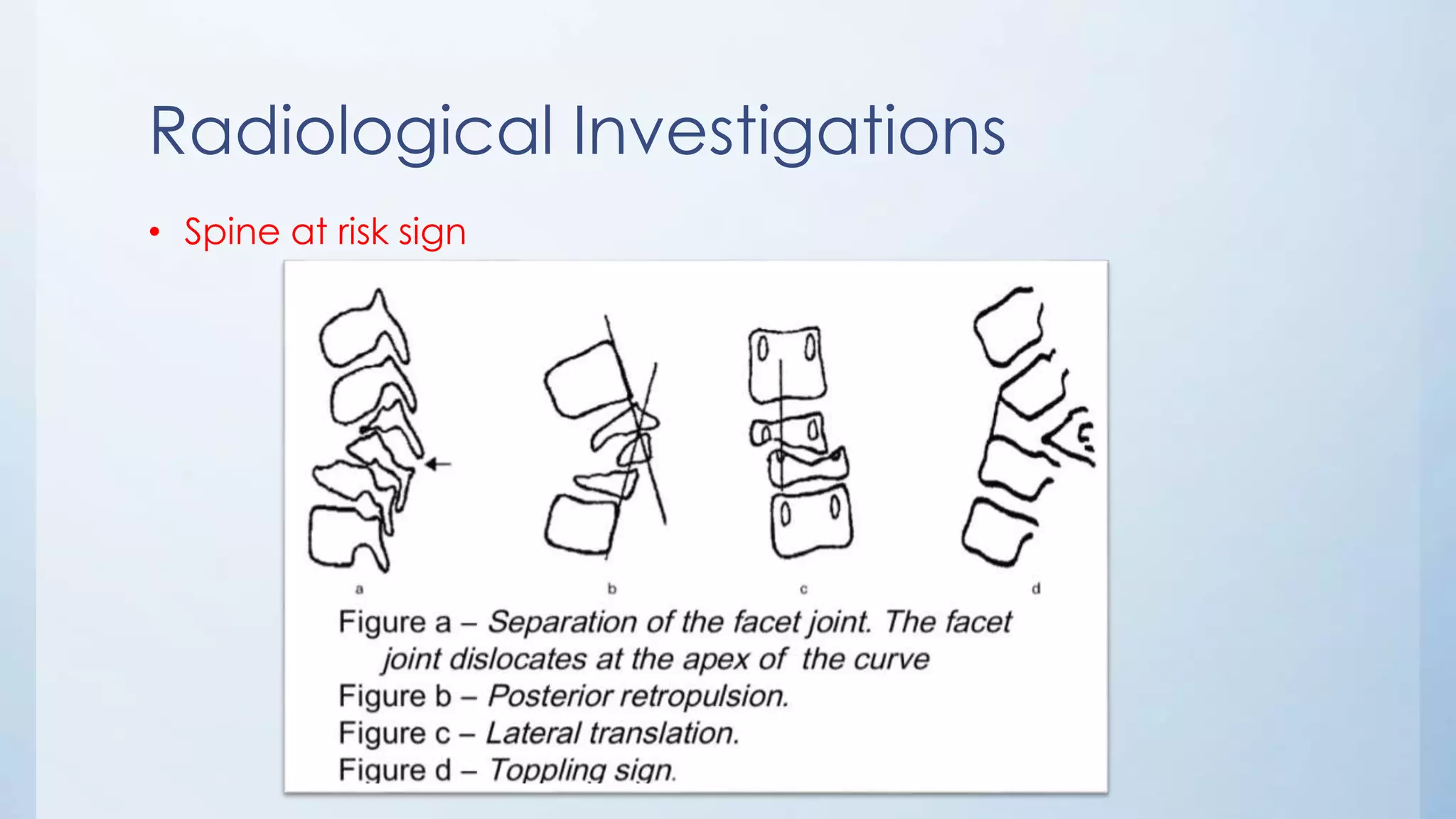 Radiological Investigations
• Spine at risk sign
 