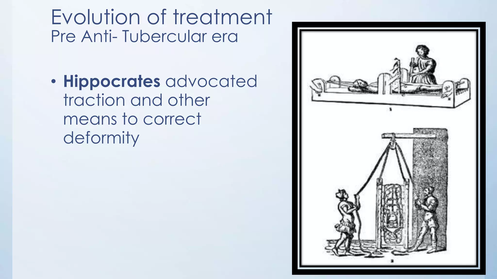 Evolution of treatment
Pre Anti- Tubercular era
• Hippocrates advocated
traction and other
means to correct
deformity
 