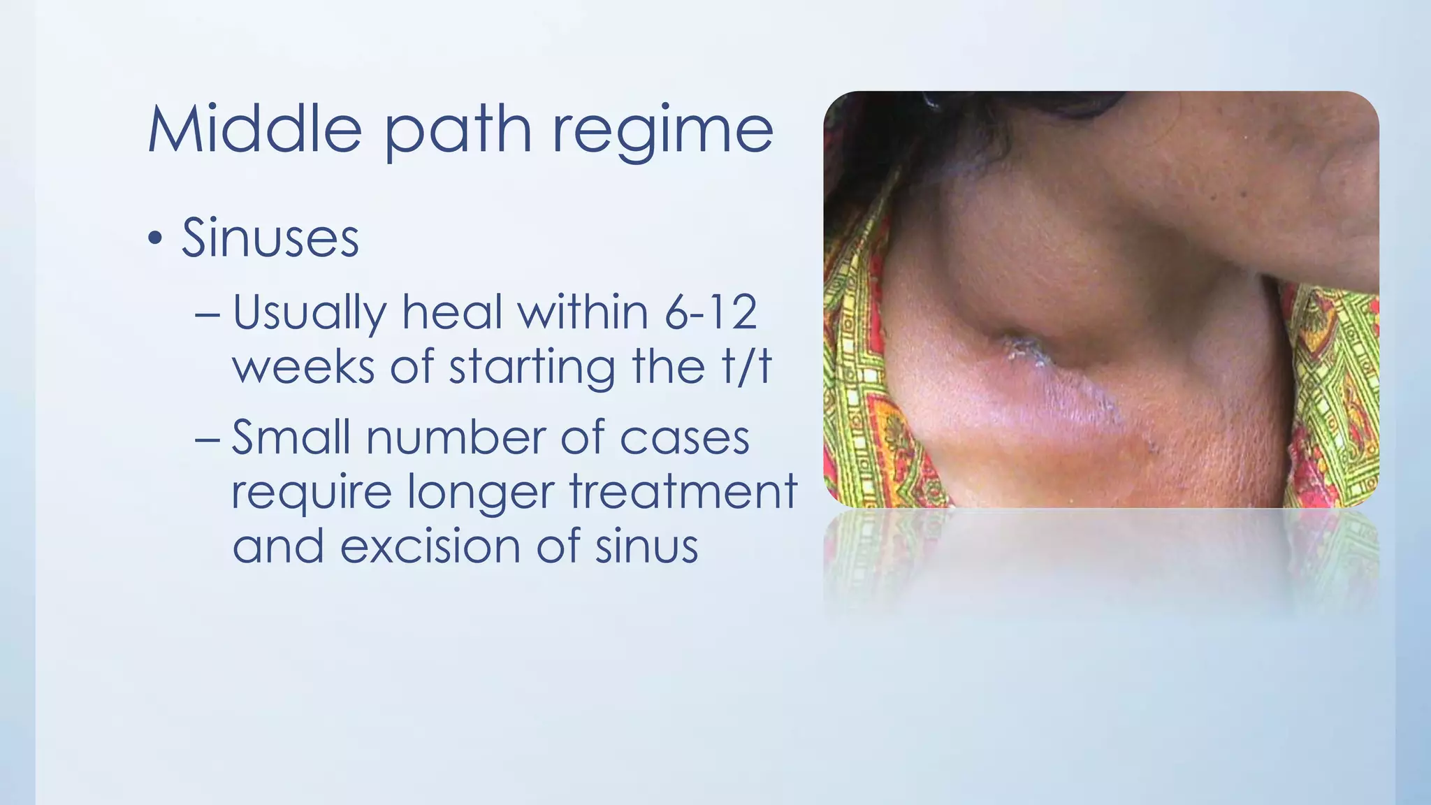 Middle path regime
• Sinuses
– Usually heal within 6-12
weeks of starting the t/t
– Small number of cases
require longer treatment
and excision of sinus
 