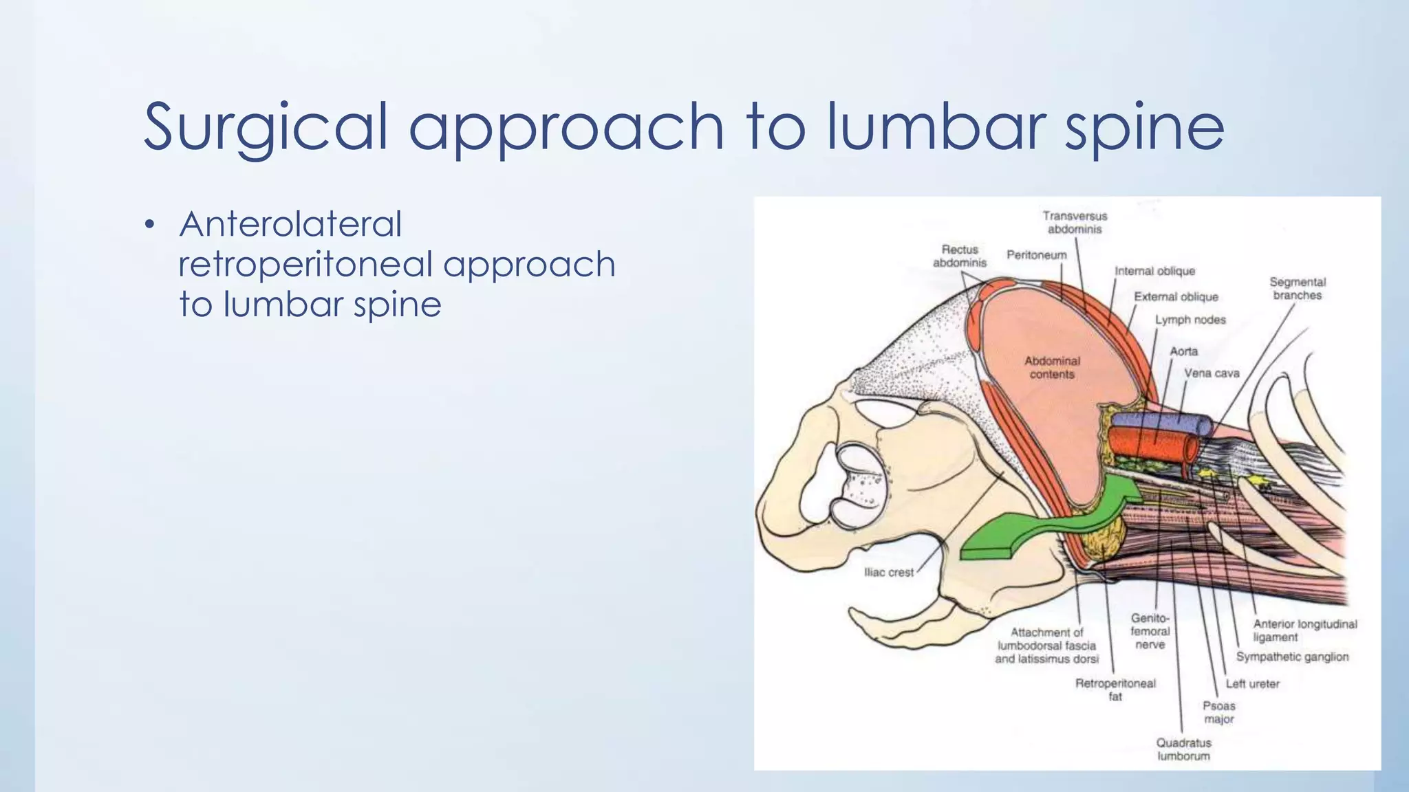 Surgical approach to lumbar spine
• Anterolateral
retroperitoneal approach
to lumbar spine
 