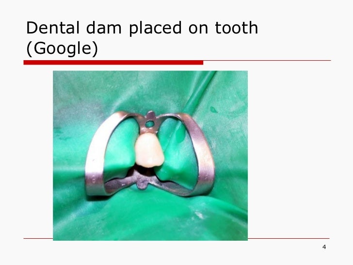 Dental dam