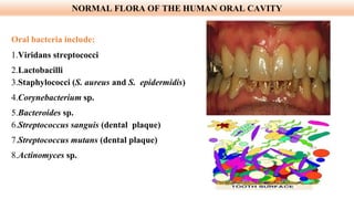 NORMAL FLORA OF THE HUMAN ORAL CAVITY
Oral bacteria include:
1.Viridans streptococci
2.Lactobacilli
3.Staphylococci (S. aureus and S. epidermidis)
4.Corynebacterium sp.
5.Bacteroides sp.
6.Streptococcus sanguis (dental plaque)
7.Streptococcus mutans (dental plaque)
8.Actinomyces sp.
 