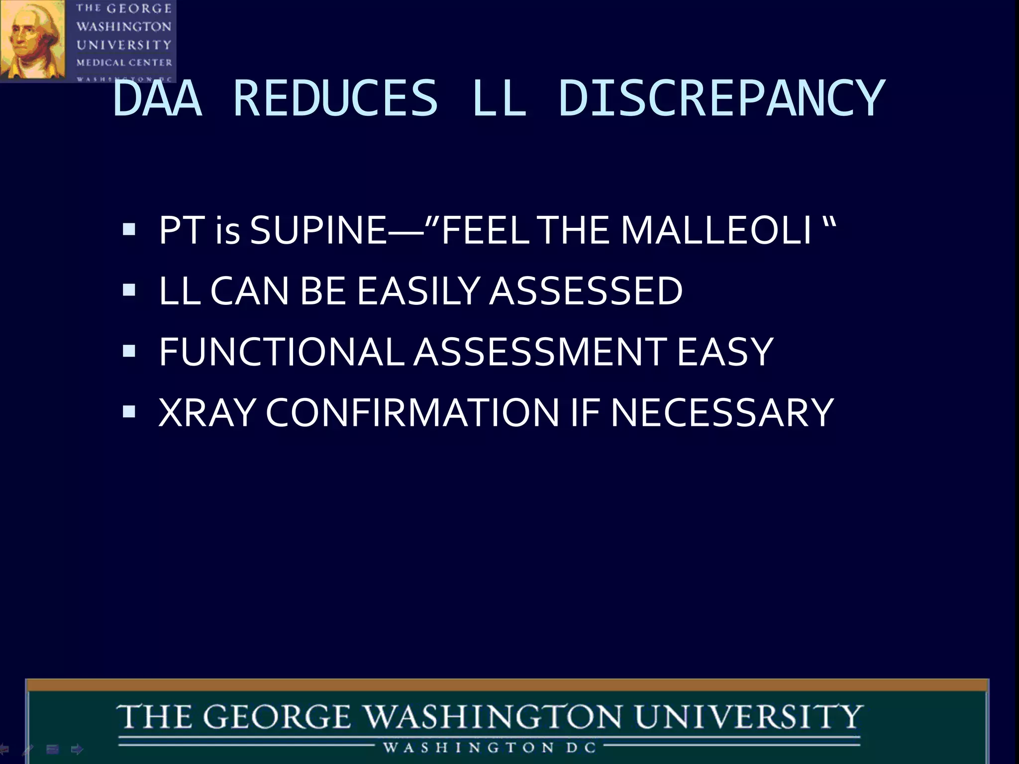DAA REDUCES LL DISCREPANCY
 PT is SUPINE—”FEELTHE MALLEOLI “
 LL CAN BE EASILY ASSESSED
 FUNCTIONALASSESSMENT EASY
 XRAY CONFIRMATION IF NECESSARY
 