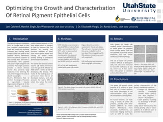 Optimizing the Growth and Characterization
Of Retinal Pigment Epithelial Cells
Lori Caldwell, Harshit Singh, Ian Wadsworth Utah State University | Dr. Elizabeth Vargis, Dr. Randy Lewis, Utah State University
Study conducted with funding from a Career Starter Grant from
Knights Templar Eye Foundation and an Undergraduate Creative
Research Opportunity grant.
Lori Caldwell
Utah State University
Department of Biological Engineering
12lcaldwell@gmail.com
I. Introduction
ARPE-19 cells were cultured in
standard T25 cell culture flasks
until a concentration of 4.5 x
10^5 cells/ mL was reached
(Figure 3). Cells were
maintained in this phase of
research using DMEM-F12
nutrient medium with 10% FBS
and 10,000 units/ mL penicillin.
9.5 cm2 six well plates were
coated with spider silk protein
(Figure 2); cells were then
seeded onto the six well plates.
The cells were maintained using
the same media for the first
two days, then changed to a 5%
FBS solution in order to prevent
cell overgrowth.
Cell confluency was measured
daily using light microscopy.
II. Methods
Cells grown on spider silk
showed similar characteristics
to those grown on standard
tissue culture plates. Cells did
not pigment in the time period
measured, but had similar
confluency and morphology.
The use of spider silk protein
makes it difficult to distinguish
cells, but cells were measured
to have 75% confluency at day
10, which was 4 days slower
than cells grown in standard
culture plates (Figure 4).
III. Results
The Spider silk protein shows
promise as a surface to grow
RPE cells on. Further research
may show advantages in cell
characterization using spider
silk compared to culture plates.
For future research, run trials
using a variety of spider silk
proteins, possibly with other
protein additives to mimic
Bruch’s Membrane more
accurately. Furthermore, use
nano-scale imaging techniques
such as SEM to study the
surface characteristics of the
Bruch’s membrane substitute
• Collagen I-V, Fibronectin,
Vascular Endothelial
Growth Factor (VEG-F),
and RGD (Arginine –
Glycine – Asparagine).
• Layer proteins according
to physiology of Bruch’s
Membrane
Lastly, future research may also
involve growing cells on micro-
patterns of 10-100 nm sizes to
promote characterization.
IV. Conclusions
Figure 4 – Time lapse of RPE cell
growth on spider silk protein matrix
over 10 days. Top left – day 2, top
right – day 4, bottom left – day 6,
bottom right – day 10. Scale = 50
μm.
Figure 1 – Schematic of cell layers comparing normal function (left)
to a patient affected by AMD (right).
The Retinal Pigment Epithelium
(RPE) is a single layer of cells
that supports photoreceptors
(rods and cones) by providing
nutrients and filtering waste
products. RPE cells grow on the
acellular Bruch’s Membrane,
which sits directly superior to
the Choroid layer, and have a
characteristic dark pigment
and grow in tight polygonal cell
junctions. These tight junctions
provide a blood vitreous
barrier that prevents large
molecules from entering the
eye while the pigment works to
absorb excess light.
Bruch’s Membrane fails to
perform its designed function
in age-related macular
degeneration (Figure 1). In this
disease, Bruch’s membrane
retains excess amounts of the
lipid drusen which is thought
to lead to reduced RPE cell
function by limiting the
nutrients available to them
from nearby blood vessels and
causing an excess waste
buildup leading to premature
photoreceptor cell death.
The Center for Disease Control
reports 1.8 million Americans
over the age of 40 affected by
AMD with 7.3 million at risk for
developing the disease. This
makes it the leading cause of
permanent vision loss in all
developed nations, and also
accounts for nearly 10% of
vision loss across the entire
world.
Figure 2 - The above images show spider silk proteins M4M5, M4, and
FLYS3 proteins respectively.
Figure 3 – ARPE – 19 cell growth after 12 weeks on M4M5, M4, and FLYS3
proteins left to right.
 