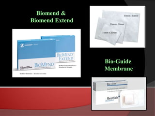 Bone Grafts | PDF