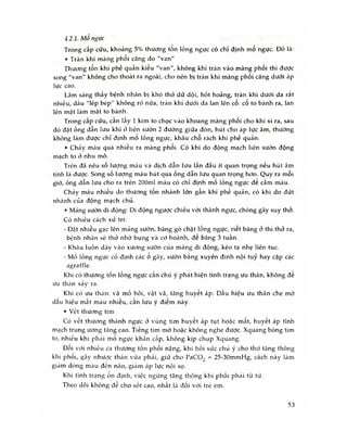 4.2.1. Mổ ngục
Trong cấp cứu, khoảng 5% thương tôn lồng ngực có chỉ định mo ngực. Đó là:
• Tràn khí màng phổi căng do "van"
Thương tổn khí phế quản kiểu "van", không khí tràn vào màng phoi thi được
song "van" không cho thoát ra ngoài, cho nên bị tràn khí màng phối căng dưới áp
lực cao.
Lâm sàng thấy bệnh nhân bị khó thớ dữ dội, hốt hoảng, tràn khí dưới da rất
nhiều, dấu "lép bép" không rõ nữa, tràn khí dưới da lan lên cổ: cổ to bành ra, lan
lên mặt làm mật to bành.
Trong câp cứu, cân lây 1 kim to chọc vào khoang màng phôi cho khí xì ra, sau
đó đặt ống dần lưu khí ỏ liên sườn 2 đường giữa đòn, hút cho áp lực âm, thường
không làm được chỉ định mô lồng ngực, khâu chỗ rách khí phế quản.
• Chảy máu quá nhiêu ra màng phôi. Có khi do động mạch liên sườn động
mạch to ỏ nhu mô.
Trên đã nêu sô lượng máu và dịch dẫn lưu lần đẩu ít quan trọng nếu hút âm
tính là được. Song số lượng máu hút qua ống dẫn lưu quan trọng hơn. Quy ra mỗi
giờ, ống dẫn lưu cho ra trên 200ml máu có chỉ định mổ lồng ngực đe cầm máu.
Cháy máu nhiều do thương ton nhánh lớn gần khí phế quàn, có khi do đứt
nhánh của động mạch chủ.
• Máng sườn di động: Di động ngược chiều vối thành ngực, chóng gây suy thỏ.
Có nhiều cách xứ trí:
- Đặt nhiều gạc lên mảng sườn, băng gò chặt lông ngực, riêt băng ở thì thỏ ra,
bệnh n h cín sẽ thỏ nhờ bụng và cơ hoành, đế băng 3 tuần.
- Khâu luồn đâv vào xương sườn của mảng di động, kéo tạ nhẹ liên tục.
- Mo lồng ngực cố định các 0 gãy, sườn bang xuyên đinh nội tuỷ hay cặp các
agraffle.
Khi có thương tốn lồng ngực cần chú ý phát hiện tình trạng ưu thán, không đế
ưu thán xảy ra.
Khi có ưu thán: vã mồ hôi, vật vã, tăng huyết áp. Dấu hiệu ưu thán che mờ
dâu hiệu mât máu nhiêu, cân lưu ý điêm này.
• vết thương tim
Có vêt thương thành ngực ở vùng tim huyêt áp tụt hoặc mât, huyêt áp tĩnh
mạch trung ương tăng cao. Tiếng tim mờ hoặc không nghe được. Xquang bóng tim
to, nhiều khi phái mo ngực khấn cấp, không kịp chụp Xquang.
Đôi với nhiều ca thương tốn phối nặng, khi hồi sức chú ý cho thớ tàng thông
khí phôi, gây nhược thán vừa phải, giữ cho PaC 02 = 25-30mmHg, cách này làm
giảm dòng máu đèn não, giảm áp lực nội sọ.
Khi tình trạng ôn định, việc ngừng tăng thông khí phối phái tù từ.
Theo dõi không đê cho sốt cao, nhất là đối vối tré em.
53
 