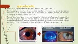 queratopatía
 Erosiones epiteliales puntiformes: que afectan a la cornea inferior
 Filamentos que constan de pequeñas bandas de moco en forma de coma,
alineadas con el epitelio y unidas por un extremo a la superficie corneal y el extremo
no unido se mueve con cada parpadeo
 Placas de moco: que consta de pequeñas lesiones epiteliales semitransparentes,
blancas o grises. Ligeramente elevadas y de diversas formas y tamaños. Están
compuestas por moco, células epiteliales y material de proteinaceo y lipoideo, suelen
verse asociadas con filamentos corneales y ambos se tiñen con rosa bengala
 