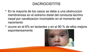 DACRIOCISTITIS
• En la mayoria de los casos se debe a una obstruccion
membranosa en el extremo distal del conducta lacrimo
nasal por canalizacion incompleto en el momento del
nacimiento
• ocurre en el 6% en lactantes y en el 90 % de ellos mejora
espontaneamente
 