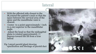 Dactography Types Dacrocysstography and Sailography | PPTX