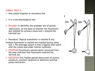 JONES TEST II-
 Also called Irrigation or secondary test.
 It is a non-physiological test.
 Principle :It identifies the probable site of partial
obstruction, on the basis of whether the fluorescein
dye instilled for primary/Jones test 1 entered the
Lacrimal sac.
 Procedure :Topical anaesthetic is instilled & any
residual fluorescein is washed out instilled during Jones
test 1.The drainage system is then irrigated with saline
with the cotton bud under inferior turbinate.
 POSITIVE:Fluorescein stained saline recovered from
the nose indicates that fluorescein entered the
lacrimal sac.
 NEGATIVE:This implies partial obstruction of puncta,
canaliculi, common canaliculi or defective lacrimal
pump mechanism.
 