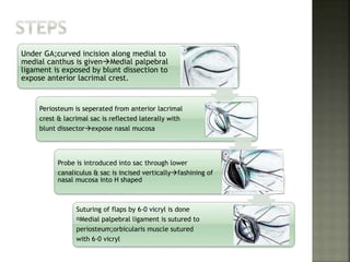 Under GA;curved incision along medial to
medial canthus is givenMedial palpebral
ligament is exposed by blunt dissection to
expose anterior lacrimal crest.
Periosteum is seperated from anterior lacrimal
crest & lacrimal sac is reflected laterally with
blunt dissectorexpose nasal mucosa
Probe is introduced into sac through lower
canaliculus & sac is incised verticallyfashining of
nasal mucosa into H shaped
Suturing of flaps by 6-0 vicryl is done
Medial palpebral ligament is sutured to
periosteum;orbicularis muscle sutured
with 6-0 vicryl
 