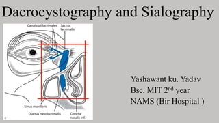 Dacrocystography and Sialography
Yashawant ku. Yadav
Bsc. MIT 2nd year
NAMS (Bir Hospital )
 
