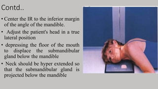 Contd..
• Center the IR to the inferior margin
of the angle of the mandible.
• Adjust the patient's head in a true
lateral position
• depressing the floor of the mouth
to displace the submandibular
gland below the mandible
• Neck should be hyper extended so
that the submandibular gland is
projected below the mandible
 