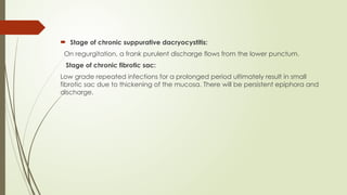  Stage of chronic suppurative dacryocystitis:
On regurgitation, a frank purulent discharge flows from the lower punctum.
Stage of chronic fibrotic sac:
Low grade repeated infections for a prolonged period ultimately result in small
fibrotic sac due to thickening of the mucosa. There will be persistent epiphora and
discharge.
 