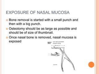EXPOSURE OF NASAL MUCOSA
 Bone removal is started with a small punch and
then with a big punch.
 Osteotomy should be as large as possible and
should be of size of thumbnail.
 Once nasal bone is removed, nasal mucosa is
exposed
 