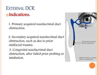 EXTERNAL DCR
Indications:
1. Primary acquired nasolacrimal duct
obstruction.
2. Secondary acquired nasolacrimal duct
obstruction, such as due to prior
midfacial trauma.
3. Congenital nasolacrimal duct
obstruction, after failed prior probing or
intubation.
 