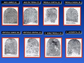 Vertificilo Dactiloscopia | PPT